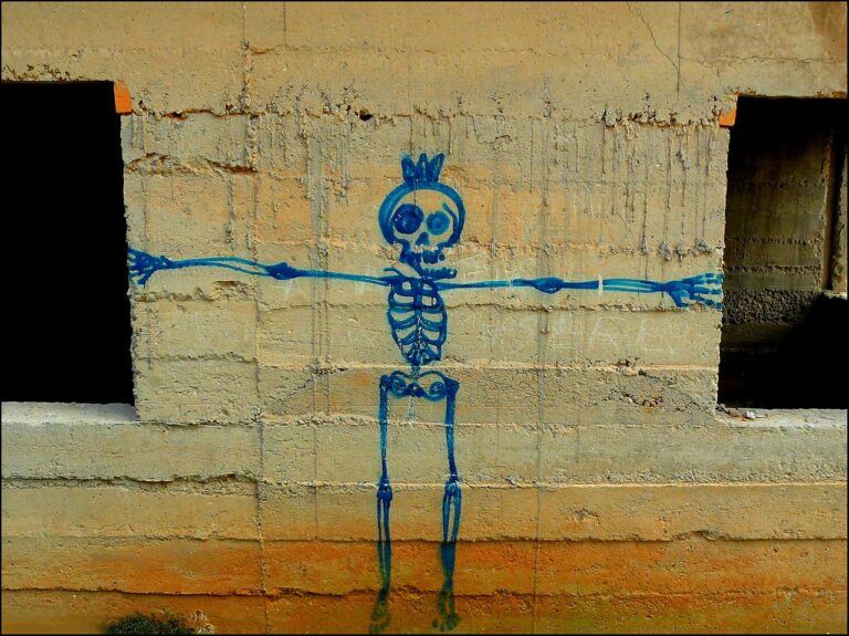 Broken Bones And Broken Emotions Shaun Lindbergh